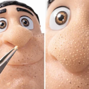 🧠 Tête à Boutons à Percer ASMR – Décompression Acné & Points Noirs